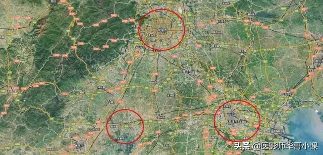 西门子mri界面讲解与操作,西门子mri序列名称