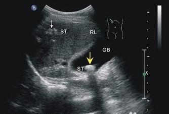 猫咪膀胱结石频繁上厕所尿少,猫咪排尿困难引起便血怎么办