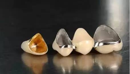 烤瓷牙的危害与副作用,全烤瓷牙有什么风险和后遗症