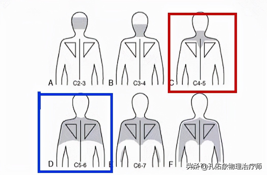 左肩膀和肩胛骨内侧肌肉会疼,右肩膀肩胛骨疼痛怎么快速缓解