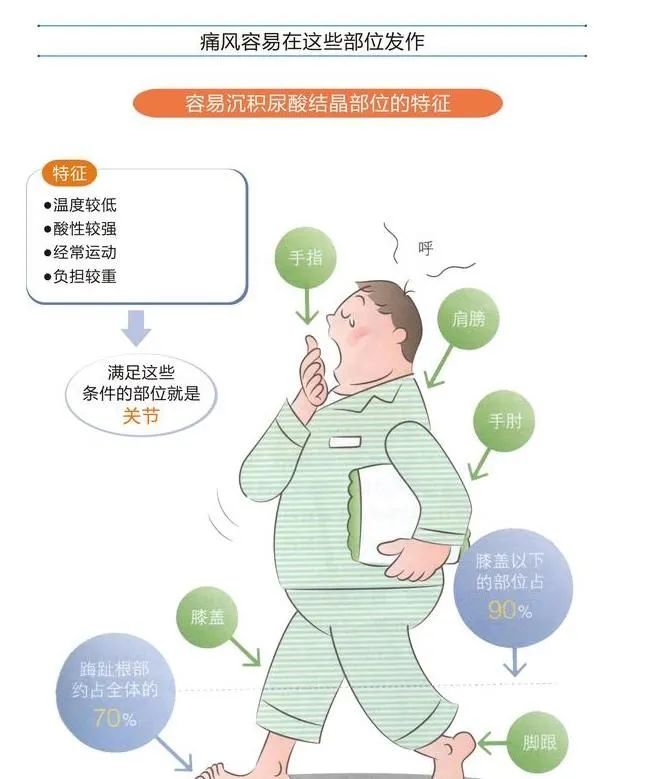 痛风总是反复不想走弯路,痛风义诊活动怎么策划