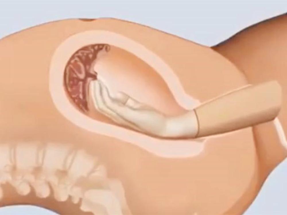 生孩子时女性骨盆的变化,生孩子产道会扩张到多少cm