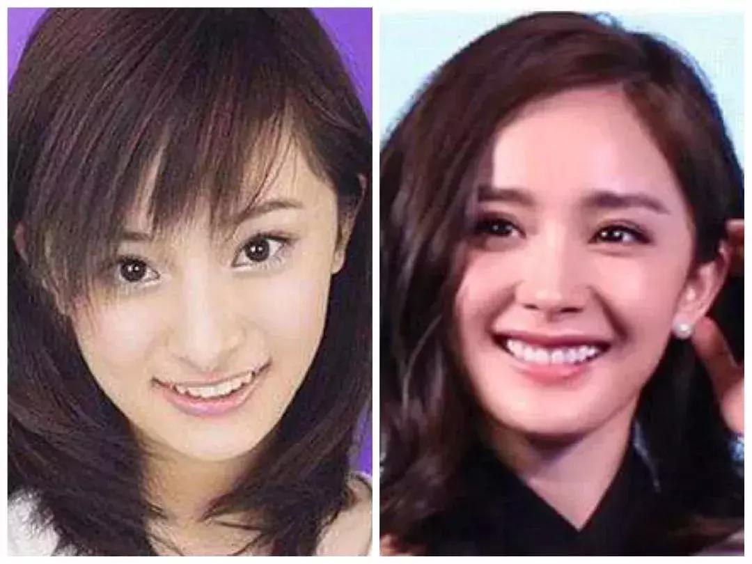 岛国人民竟然流行“八重齿”！*牙虎**真的可爱吗？