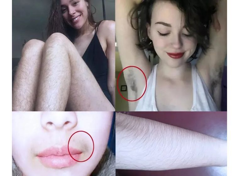 j-style冰点脱毛仪,j-style光子嫩肤脱毛仪