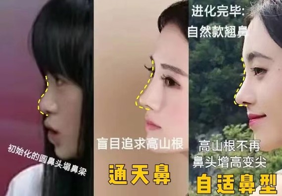 好看的鼻子类型驼峰鼻,好看的鼻型有哪几种