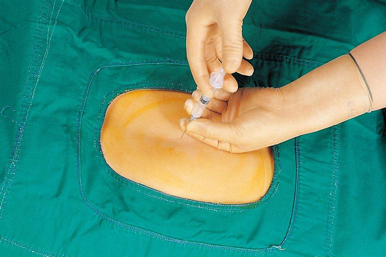 顺产、剖腹产、无痛分娩，一文讲清其中区别，打消你的所有顾虑