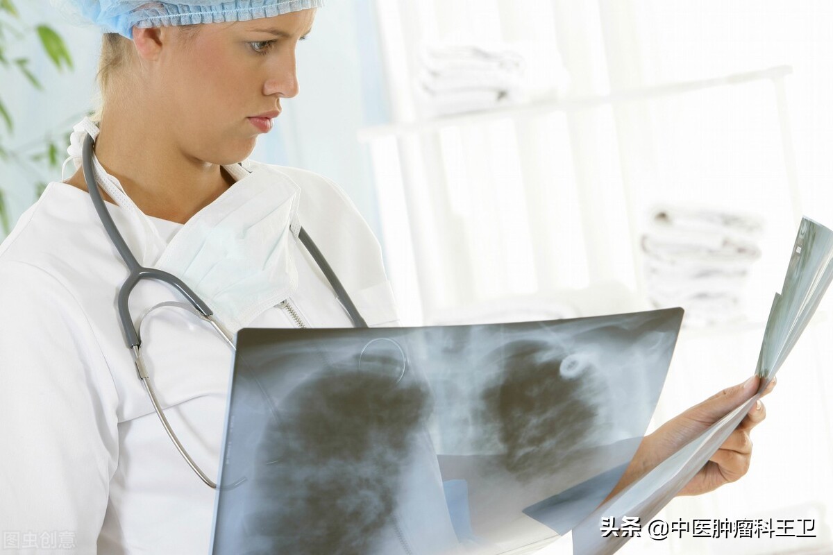 中医经方怎么治癌症,中医治疗癌症健脾是关键