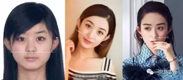 颅顶太低如何自救,颅顶低怎么自救