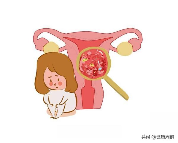 总是反反复复，阴道炎为什么难断根？妇科医生：原因无非这5个