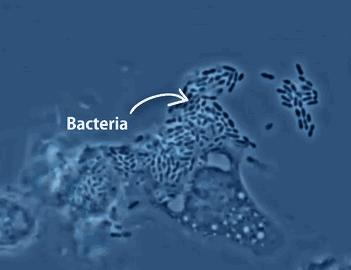 hpv疫苗接种注意事项及禁忌,月经期间可以接种hpv疫苗吗