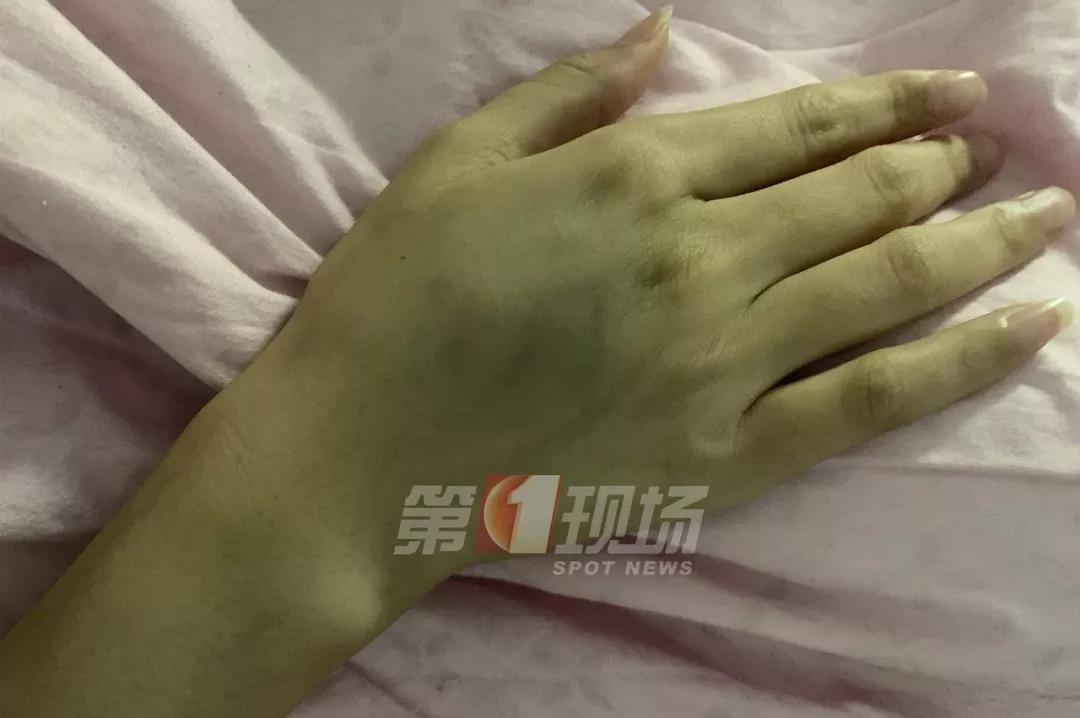 女子投诉快递员遭上门暴打,女子投诉快递员竟然遭登门暴打