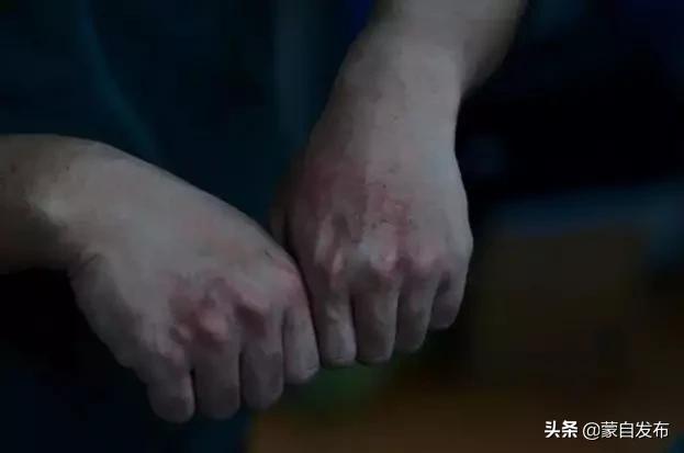 暖心逆行,暖心他们逆行而上为一线送铠甲