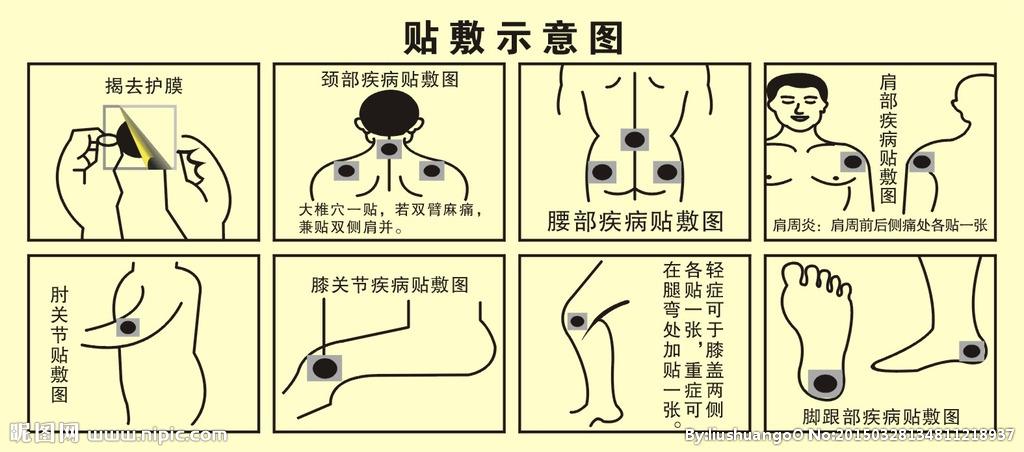 贴上膏药后应注意什么啊,贴膏药需注意哪些事项