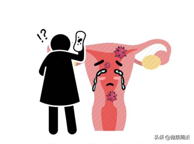 提醒女性：身体无端端出现4种迹象，千万别拖，尽快去医院排查HPV