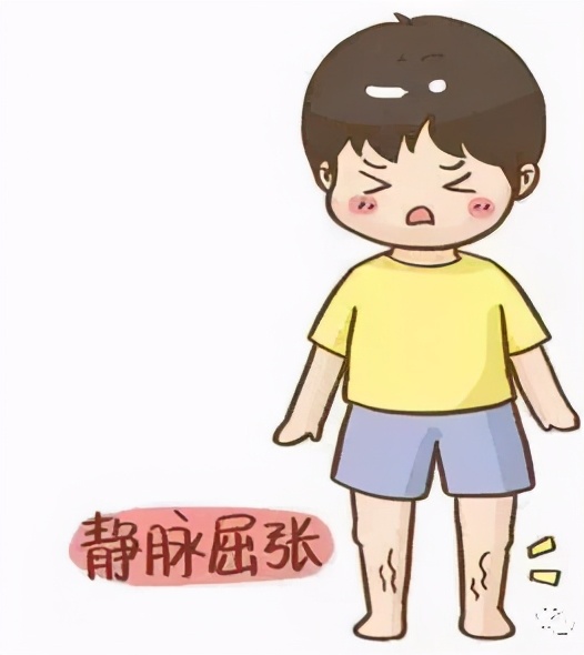 静脉曲张不痛不痒被忽视,精索静脉曲张不痛不痒影响生育吗