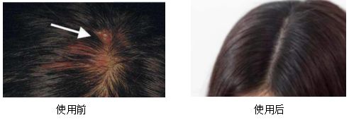 90后怎么防脱 (90后该如何防脱)