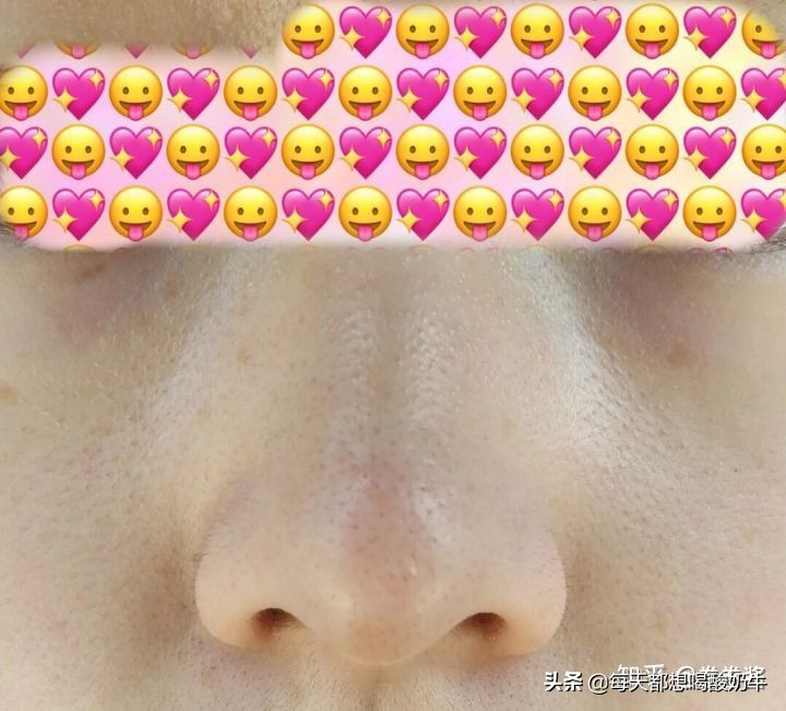 化妆之后毛孔变得粗大，皮肤黯淡无光，应该怎么护肤？