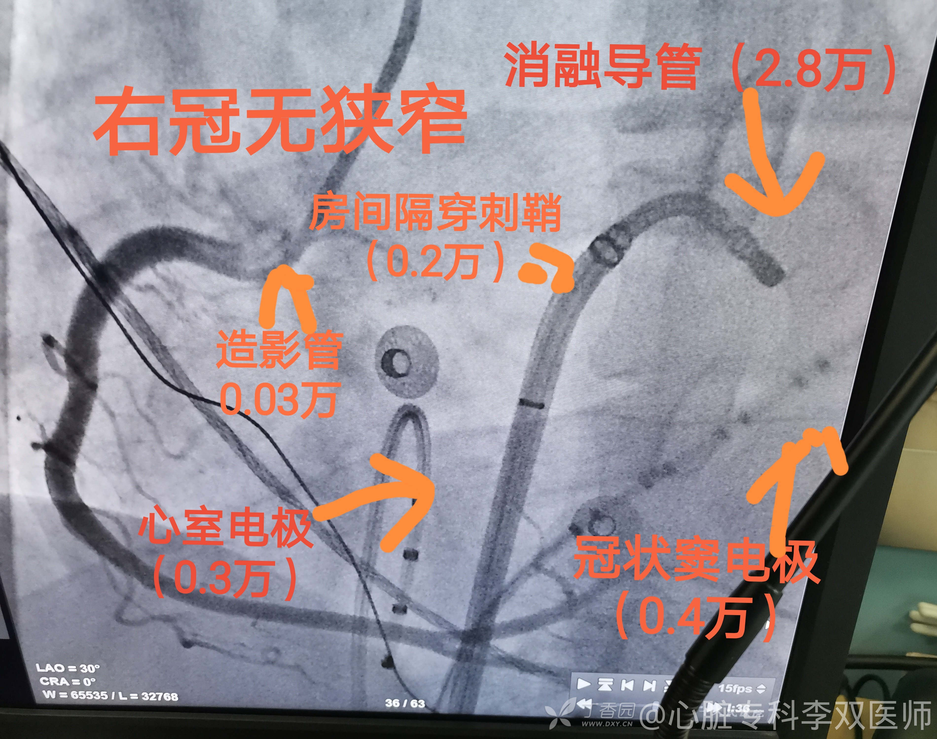 缁欒繙鍦ㄤ粬涔＄殑缃戝弸鎯呬功,缁欒繙鍦ㄤ粬涔＄殑缃戝弸瀵勪粈涔堢ぜ鐗╁ソ
