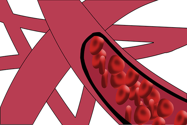 身上突然出现小红痣是什么原因,身体出现许多小红痣是什么原因