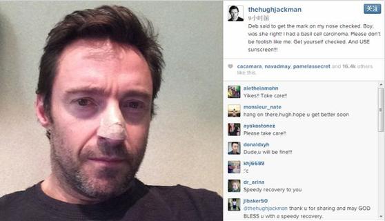 痣出现的位置真的重要吗,痣相大揭秘来看看吧