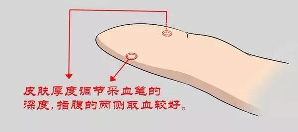 在家测血糖仪不准怎么办,糖友自己检测血糖值