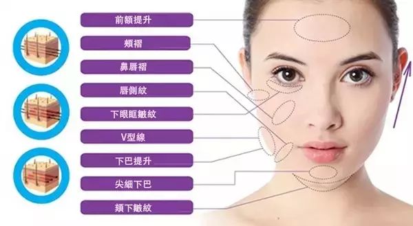 王祖贤到底有没有整容,王祖贤整容成功了吗