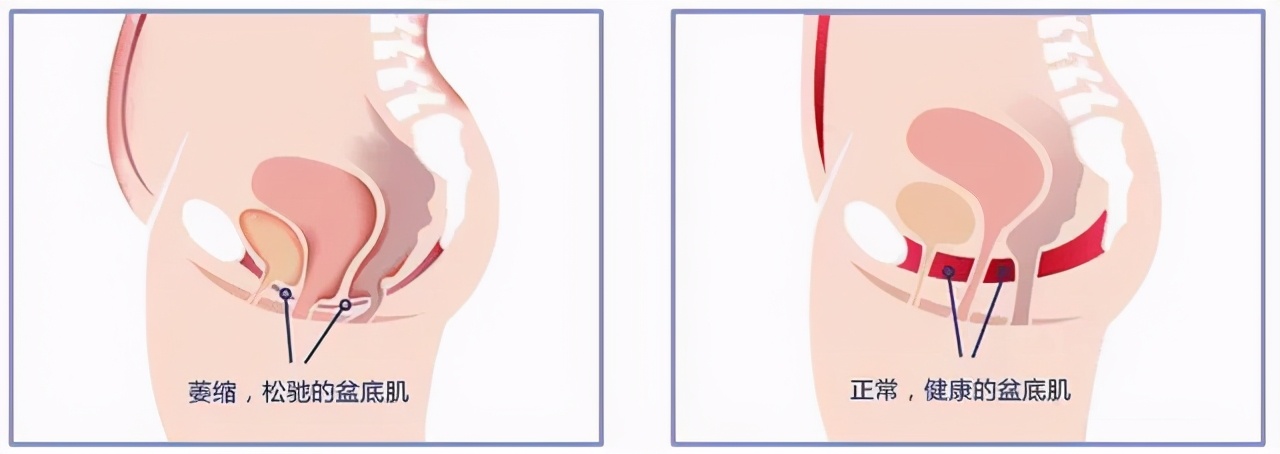 大家都在避讳这个问题,那么我来说吧