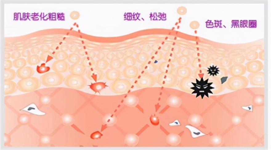 医美科普最新视频解说,医美祛斑科普介绍