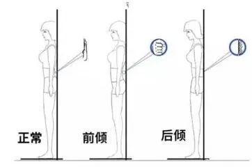 你渴望的“前凸后翘”很可能会毁了你真正的美感，痛不堪言