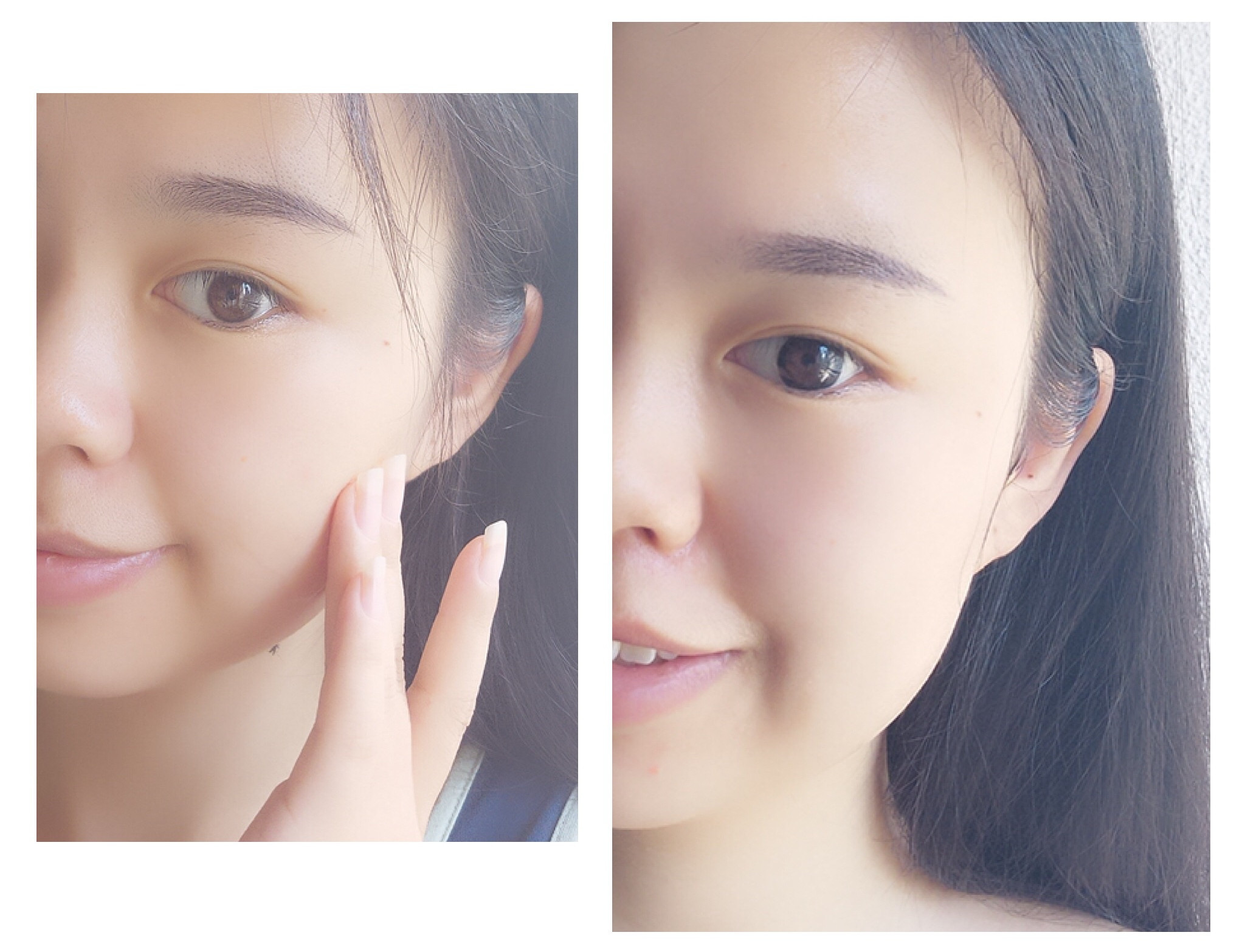 秋冬换季皮肤过敏怎么办,换季皮肤过敏用什么护肤