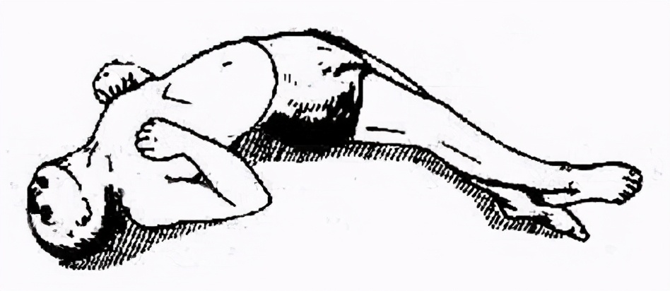 外伤处理后必须要打破伤风吗,受伤后为什么要打破伤风针