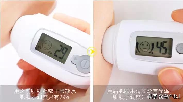 腿上有鱼鳞皮屑怎么办,腿上起皮屑就是鱼鳞病