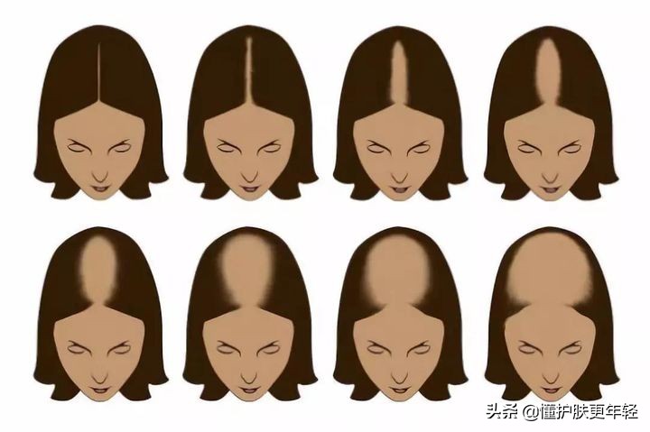 脸大的女生留什么发型好看有刘海,发型设计与脸型搭配男生发型