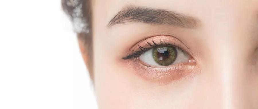 红斑狼疮患者护眼五步骤，还你一双BlingBling大眼睛