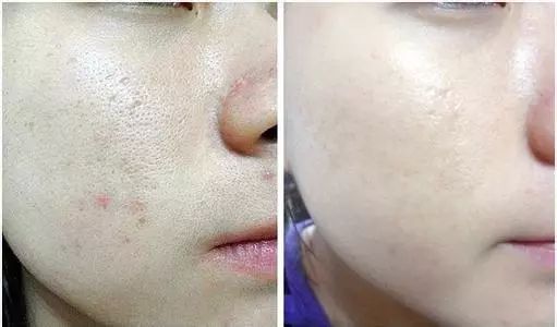 小黄瓜面霜保湿效果好吗,抗老修护保湿面霜澳洲