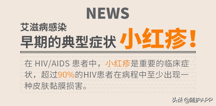 hiv的小红疹长什么样,hiv的小红点是病毒疹吗