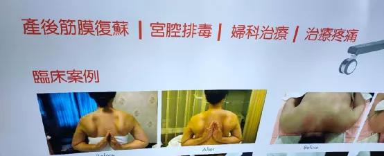 网上卖的妊娠纹修复霜真的有用吗,预防妊娠纹涂的是智商税吗