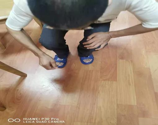 膝关节不能下蹲针刀松解,膝关节疼痛久治不愈怎么回事