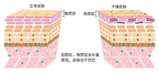 皮肤缺水的五大症状,皮肤出黄水很难好