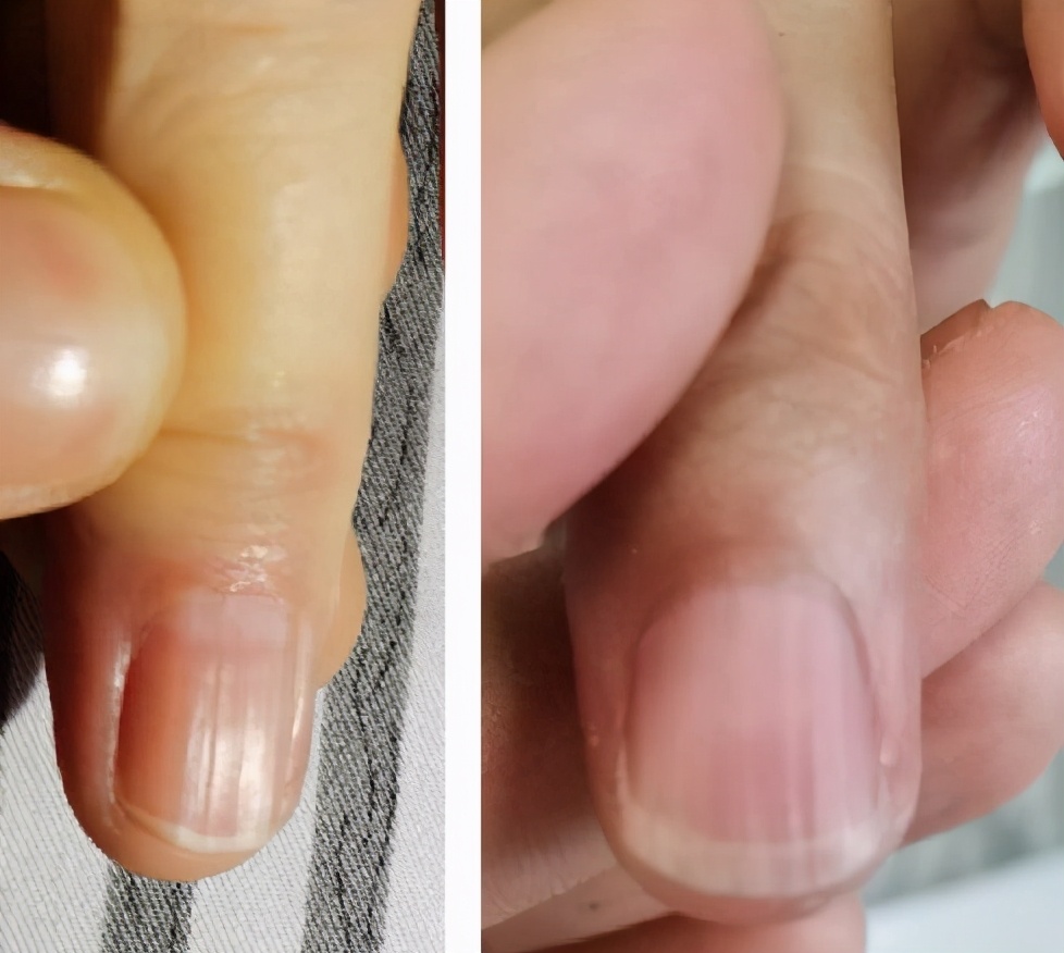 阿胶补哪里的血,吃阿胶红糖补血吗