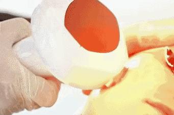 追求素颜肌必做项目之光子嫩肤——做之前需要知道的那些事