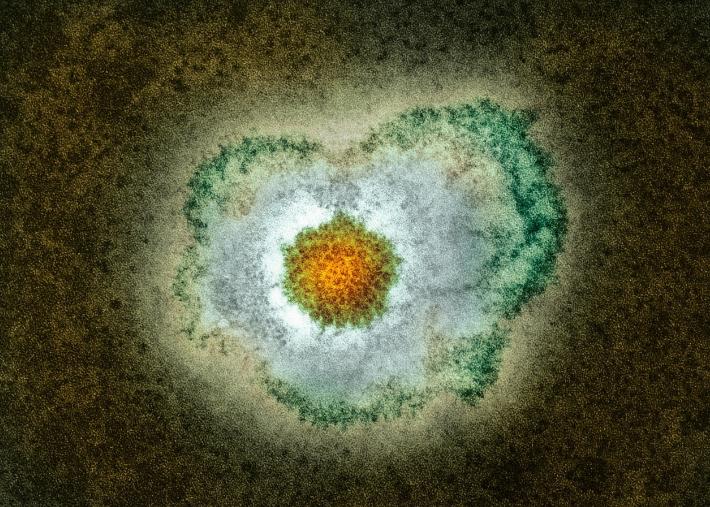 治单纯性疱疹的最好方法,中医治单纯疱疹最好办法