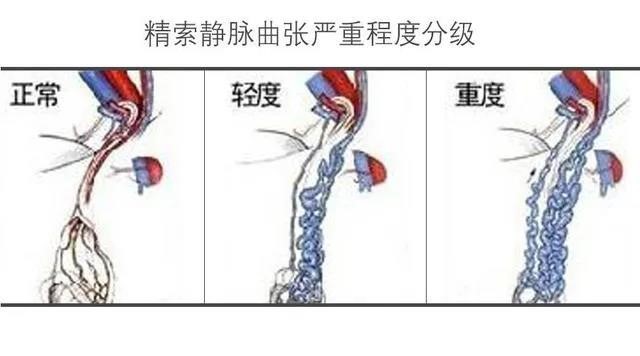 苏州九龙医院o型腿手术,苏州九龙医院做静脉曲张微创手术