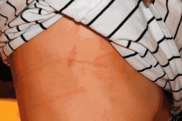 99%的女生都可能得的妇科疾病,99%的女生所不知道的小秘密