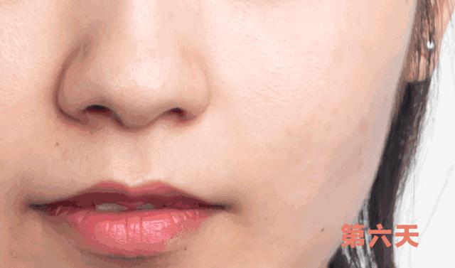 微晶法令纹贴抗皱纹提拉紧致面膜,淡纹抗皱法令纹面膜推荐