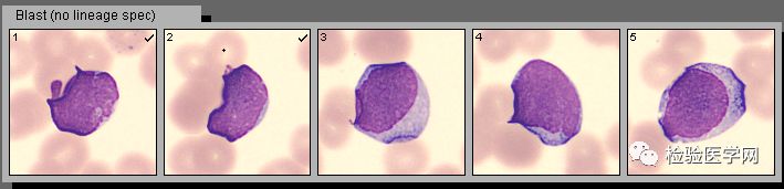 看懂血常规报告单只需明白这四项,宝宝做血常规要注意什么