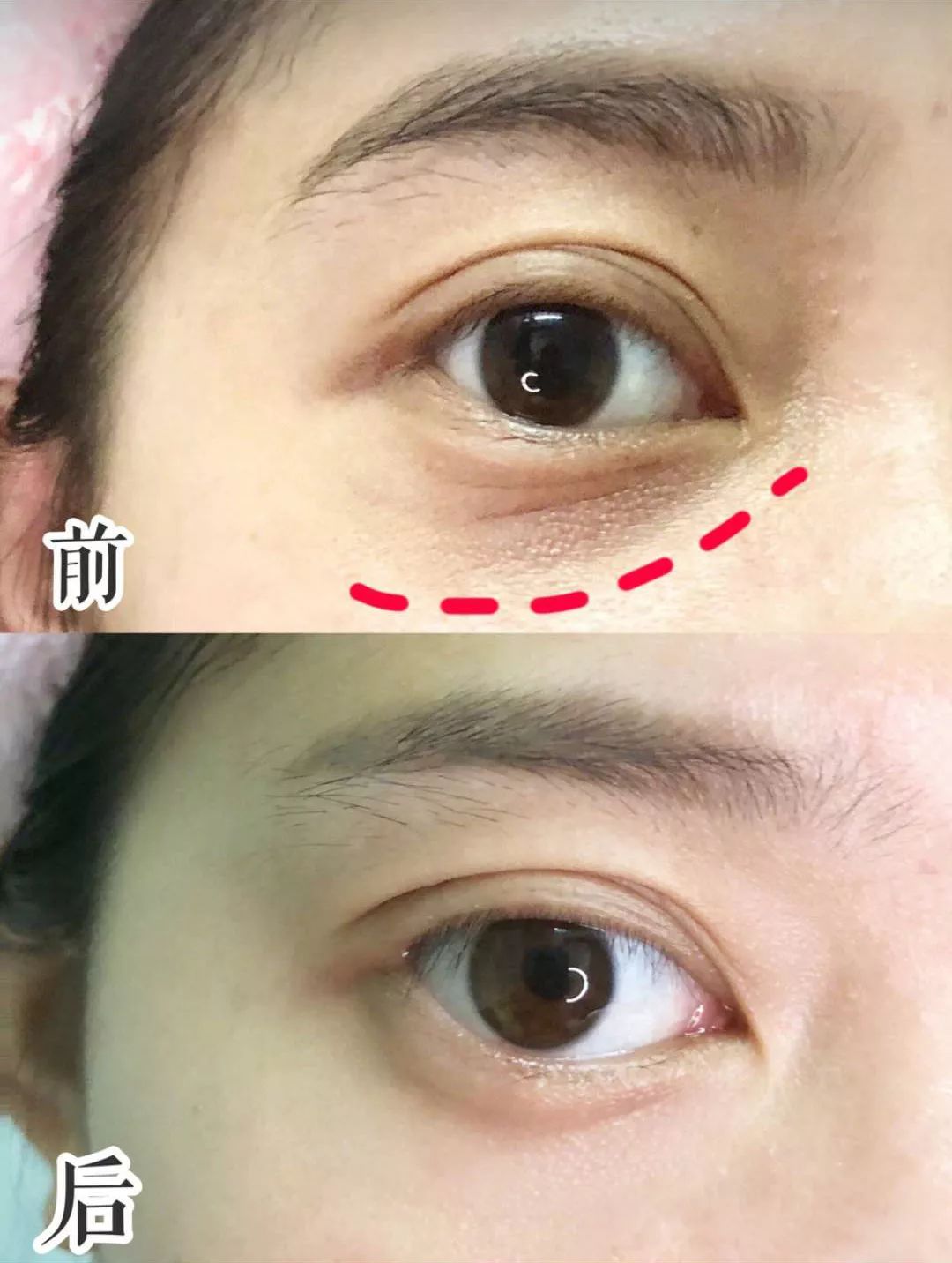 每天喷2下，近视竟然降低了200度？西班牙人都买疯了！还能缓解眼部疲劳，预防老花眼、白内障！