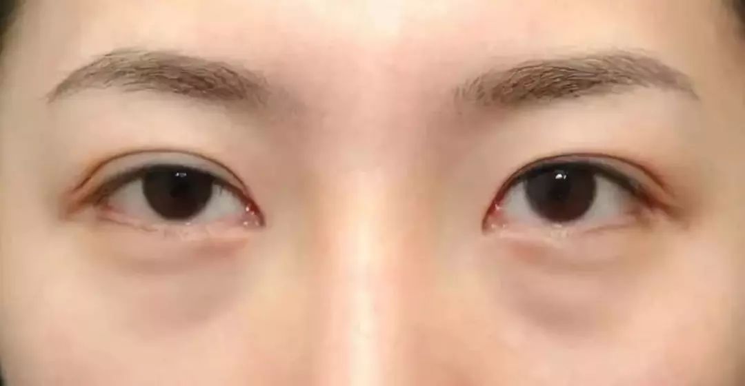 母亲节别把孝顺停留在朋友圈,母亲节不要忘了爱自己