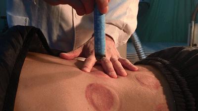 「传统医药日」秋冬预防季节性疾病，巧用艾条“自灸”益处多