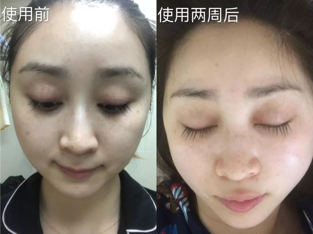 来自日本的HQ祛斑霜,一月一支,淡斑抗皱,让肤色重回净白透亮